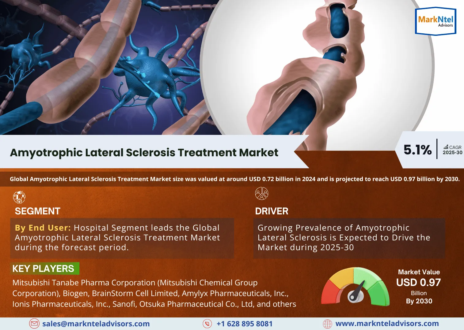 Global Amyotrophic Lateral Sclerosis Treatment Market Research Report: Forecast (2025-2030)