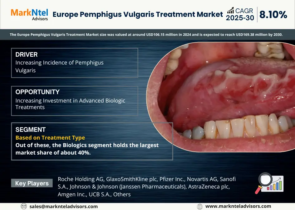 Europe Pemphigus Vulgaris Treatment Market Forecast 2025-30
